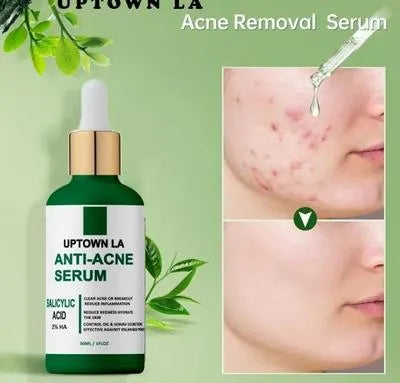 Anti-Acne Serum